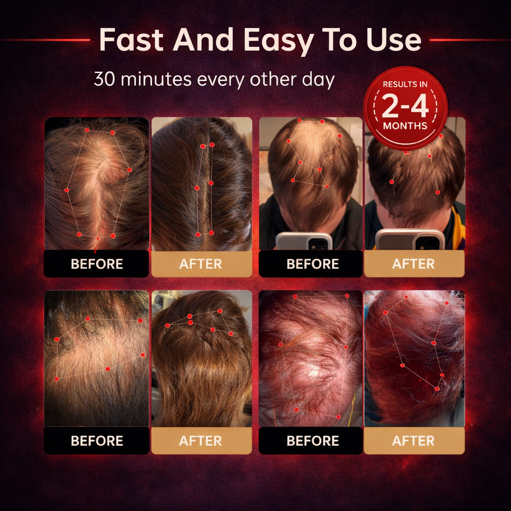 ZENVIBA™ - Red Light Therapy Regrowth Cap-OA