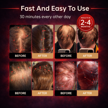ZENVIBA™ - Red Light Therapy Regrowth Cap-OA
