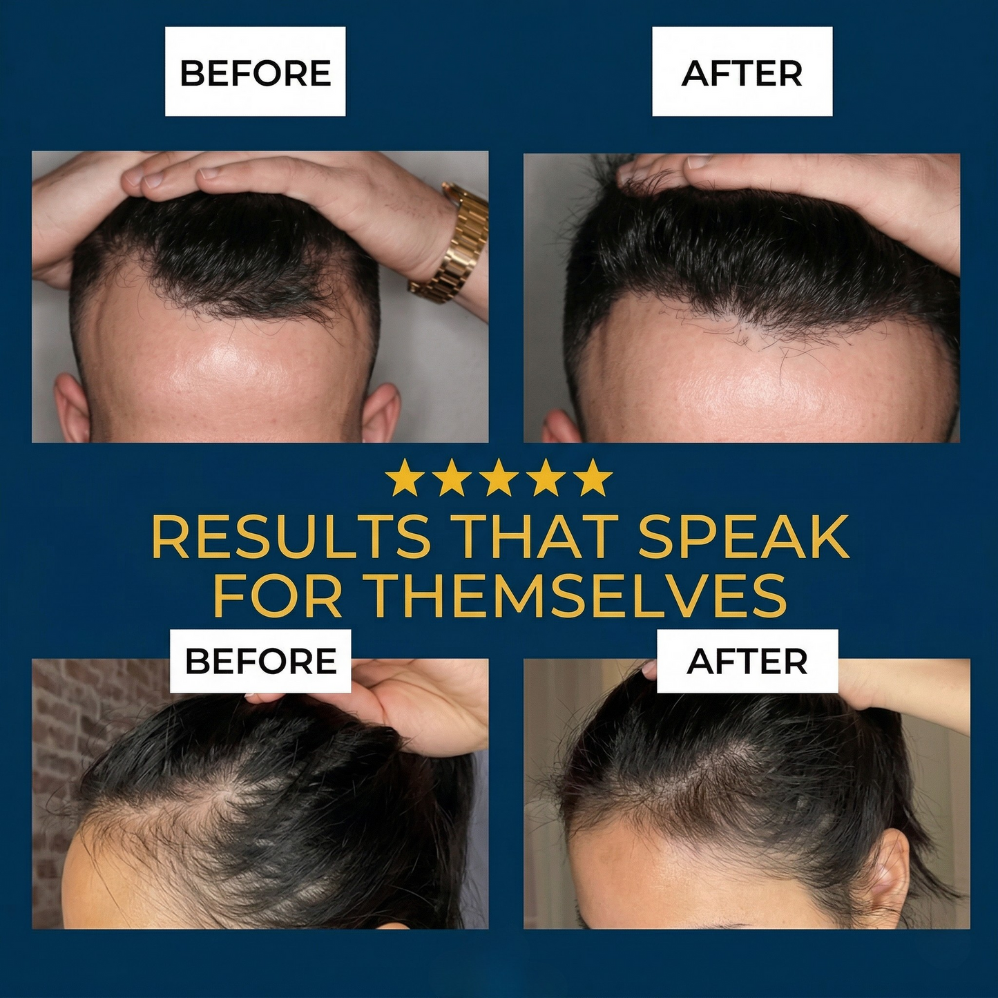 Advanced Hair Density Roll-On Serum-Rush